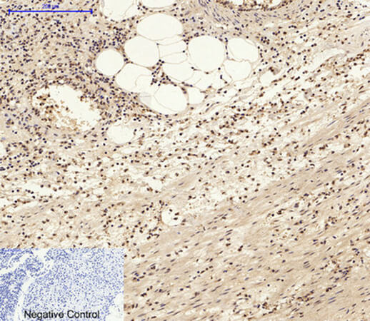 Fig.1. Immunohistochemical analysis of paraffin-embedded human appendix tissue. 1, AP-1 Polyclonal Antibody was diluted at 1:200 (4°C, overnight). 2, Sodium citrate pH 6.0 was used for antibody retrieval (>98°C, 20min). 3, secondary antibody was diluted at 1:200 (room temperature, 30min). Negative control was used by secondary antibody only.