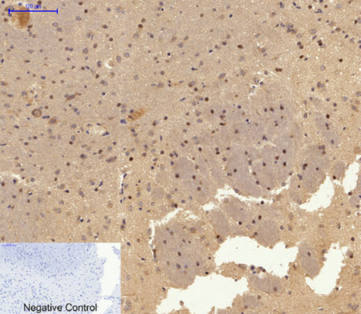 Fig.2. Immunohistochemical analysis of paraffin-embedded rat brain tissue. 1, AP-1 Polyclonal Antibody was diluted at 1:200 (4°C, overnight). 2, Sodium citrate pH 6.0 was used for antibody retrieval (>98°C, 20min). 3, secondary antibody was diluted at 1:200 (room temperature, 30min). Negative control was used by secondary antibody only.