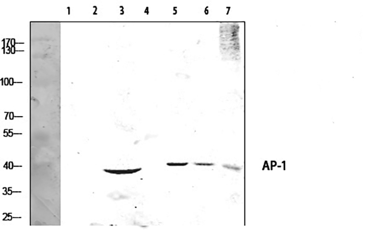 Fig.3. Western Blot analysis of mouse kidney(1), mouse heart(2), mouse brain(3), mouse lung(4), Hela(5), KB(6), CACO-2(7), diluted at 1:1000.