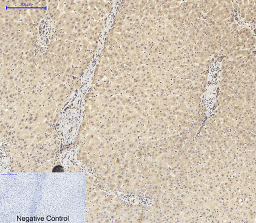 Fig.1. Immunohistochemical analysis of paraffin-embedded human liver tissue. 1, ASC Polyclonal Antibody was diluted at 1:200 (4°C, overnight). 2, Sodium citrate pH 6.0 was used for antibody retrieval (>98°C, 20min). 3, secondary antibody was diluted at 1:200 (room temperature, 30min). Negative control was used by secondary antibody only.
