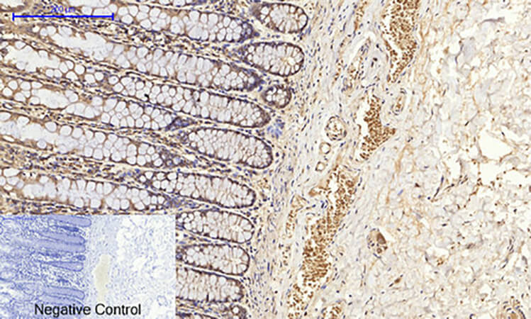 Fig.4. Immunohistochemical analysis of paraffin-embedded human colon tissue. 1, Bcl-x Polyclonal Antibody was diluted at 1:200 (4°C, overnight). 2, Sodium citrate pH 6.0 was used for antibody retrieval (>98°C, 20min). 3, secondary antibody was diluted at 1:200 (room temperature, 30min). Negative control was used by secondary antibody only.