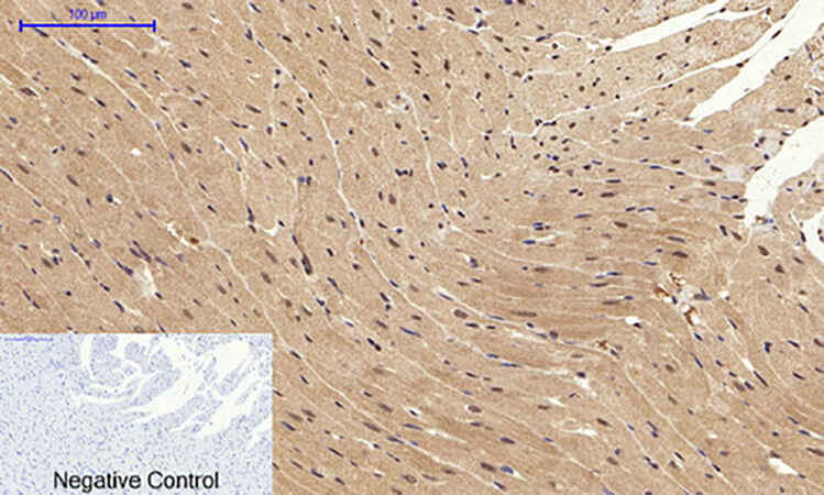 Fig.5. Immunohistochemical analysis of paraffin-embedded rat heart tissue. 1, Bcl-x Polyclonal Antibody was diluted at 1:200 (4°C, overnight). 2, Sodium citrate pH 6.0 was used for antibody retrieval (>98°C, 20min). 3, secondary antibody was diluted at 1:200 (room temperature, 30min). Negative control was used by secondary antibody only.