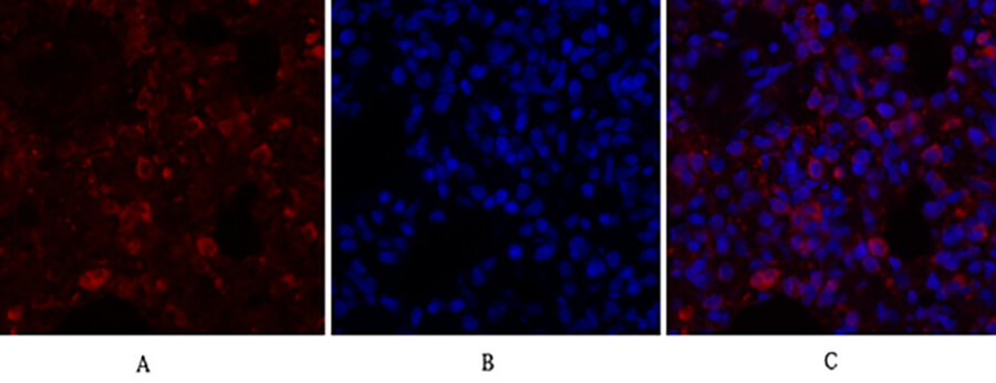 Fig.1. Immunofluorescence analysis of rat lung tissue. 1, Calnexin Polyclonal Antibody (red) was diluted at 1:200 (4°C, overnight). 2, Cy3 labeled secondary antibody was diluted at 1:300 (room temperature, 50min). 3, Picture B: DAPI (blue) 10min. Picture A: Target. Picture B: DAPI. Picture C: merge of A+B.