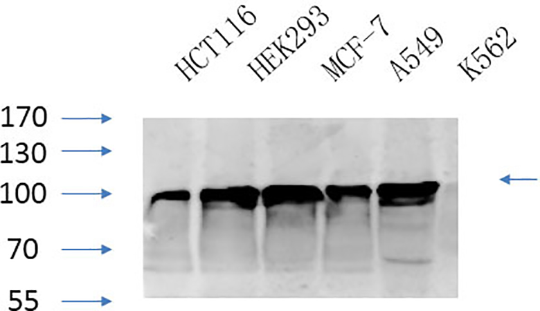 Fig.5. Western Blot analysis of HCT116 (1), HEK293 (2), MCF-7 (3), A594 (4), K562 (5), diluted at 1:1000.