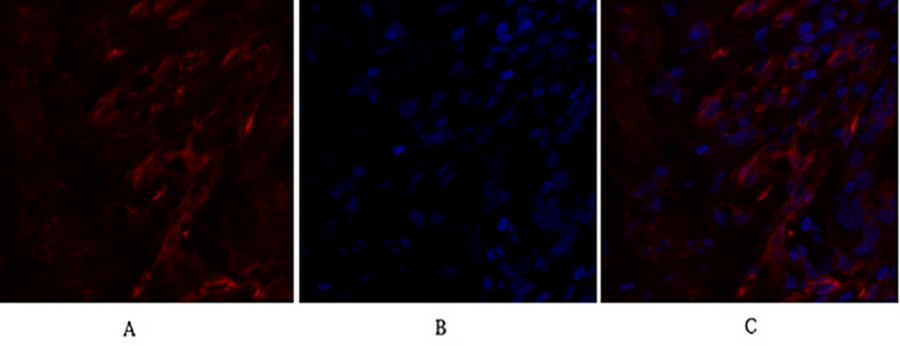 Fig.1. Immunofluorescence analysis of human lung tissue. 1, Caveolin-1 Polyclonal Antibody (red) was diluted at 1:200 (4°C, overnight). 2, Cy3 labeled secondary antibody was diluted at 1:300 (room temperature, 50min). 3, Picture B: DAPI (blue) 10min. Picture A: Target. Picture B: DAPI. Picture C: merge of A+B.