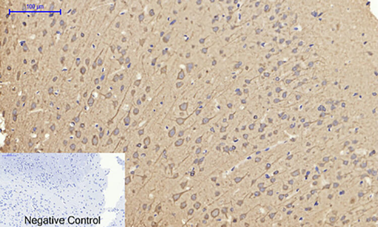 Fig.4. Immunohistochemical analysis of paraffin-embedded rat brain tissue. 1, Caveolin-1 Polyclonal Antibody was diluted at 1:200 (4°C, overnight). 2, Sodium citrate pH 6.0 was used for antibody retrieval (>98°C, 20min). 3, secondary antibody was diluted at 1:200 (room temperature, 30min). Negative control was used by secondary antibody only.