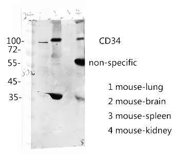 Fig.3. mouse-lung mouse-brain mouse-spleen mouse-kidney.