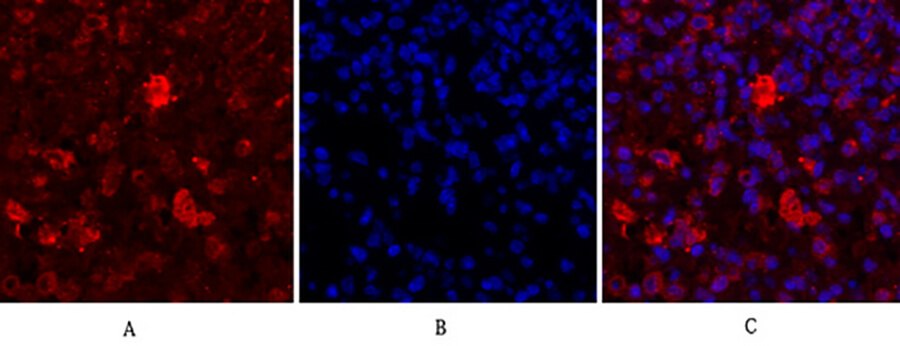 Fig.3. Immunofluorescence analysis of mouse lung tissue. 1, Cdc2 Polyclonal Antibody (red) was diluted at 1:200 (4°C, overnight). 2, Cy3 labeled secondary antibody was diluted at 1:300 (room temperature, 50min). 3, Picture B: DAPI (blue) 10min. Picture A: Target. Picture B: DAPI. Picture C: merge of A+B.