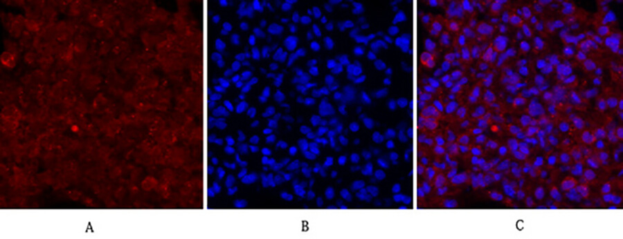 Fig.4. Immunofluorescence analysis of rat lung tissue. 1, Cdc2 Polyclonal Antibody (red) was diluted at 1:200 (4°C, overnight). 2, Cy3 labeled secondary antibody was diluted at 1:300 (room temperature, 50min). 3, Picture B: DAPI (blue) 10min. Picture A: Target. Picture B: DAPI. Picture C: merge of A+B.