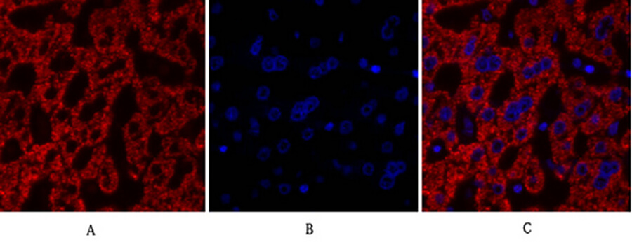 Fig.1. Immunofluorescence analysis of human liver tissue. 1, Cdk2 Polyclonal Antibody (red) was diluted at 1:200 (4°C, overnight). 2, Cy3 labeled secondary antibody was diluted at 1:300 (room temperature, 50min). 3, Picture B: DAPI (blue) 10min. Picture A: Target. Picture B: DAPI. Picture C: merge of A+B.