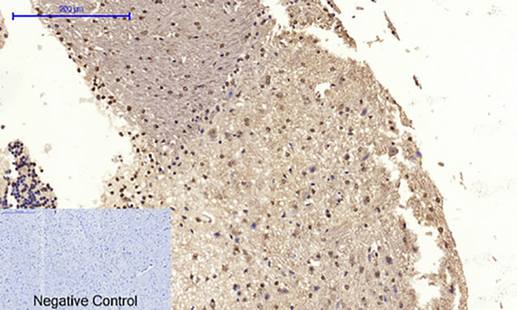 Fig.3. Immunohistochemical analysis of paraffin-embedded mouse brain tissue. 1, Cdk2 Polyclonal Antibody was diluted at 1:200 (4°C, overnight). 2, Sodium citrate pH 6.0 was used for antibody retrieval (>98°C, 20min). 3, secondary antibody was diluted at 1:200 (room temperature, 30min). Negative control was used by secondary antibody only.