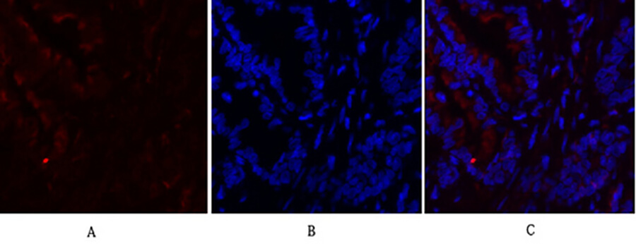 Fig.3. Immunofluorescence analysis of rat lung tissue. 1, c-Fos Polyclonal Antibody (red) was diluted at 1:200 (4°C, overnight). 2, Cy3 labeled secondary antibody was diluted at 1:300 (room temperature, 50min). 3, Picture B: DAPI (blue) 10min. Picture A: Target. Picture B: DAPI. Picture C: merge of A+B.