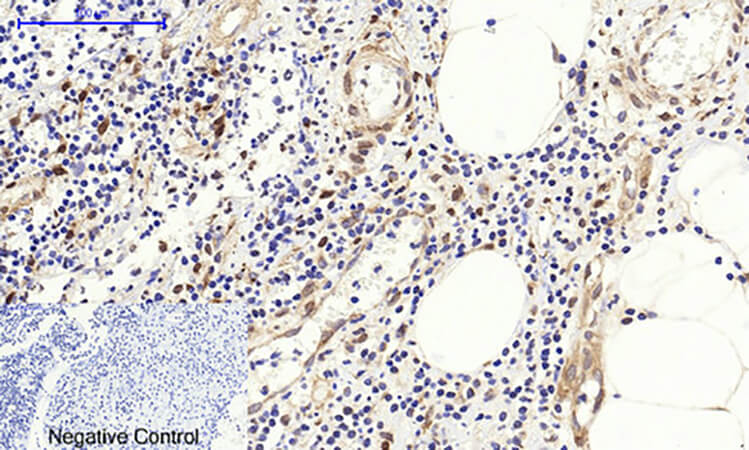 Fig.4. Immunohistochemical analysis of paraffin-embedded human appendix tissue. 1, c-Fos Polyclonal Antibody was diluted at 1:200 (4°C, overnight). 2, Sodium citrate pH 6.0 was used for antibody retrieval (>98°C, 20min). 3, secondary antibody was diluted at 1:200 (room temperature, 30min). Negative control was used by secondary antibody only.