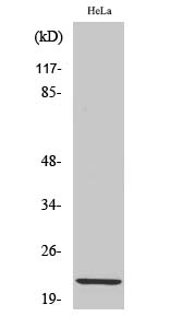 Fig. Western Blot analysis of various cells using Claudin-1 Polyclonal Antibody diluted at 1:1000.