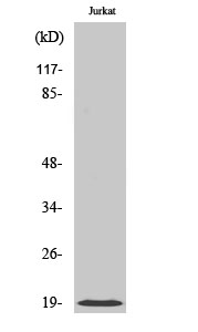 Fig. Western Blot analysis of various cells using Cofilin Polyclonal Antibody diluted at 1:500.