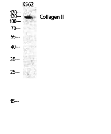 Fig.1. Western Blot analysis of various cells using COL2A1 Polyclonal Antibody diluted at 1:1000.