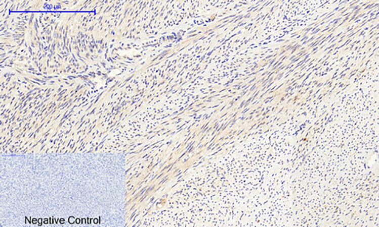 Fig.3. Immunohistochemical analysis of paraffin-embedded human uterus tissue. 1, COL2A1 Polyclonal Antibody was diluted at 1:200 (4°C, overnight). 2, Sodium citrate pH 6.0 was used for antibody retrieval (>98°C, 20min). 3, secondary antibody was diluted at 1:200 (room temperature, 30min). Negative control was used by secondary antibody only.