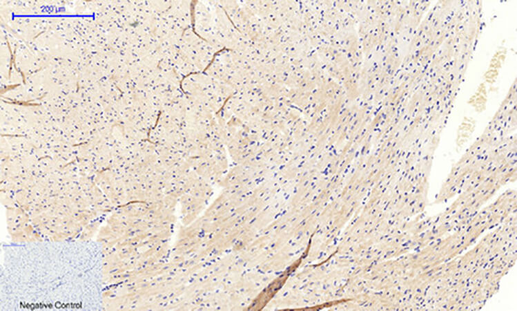 Fig.4. Immunohistochemical analysis of paraffin-embedded mouse heart tissue. 1, COL2A1 Polyclonal Antibody was diluted at 1:200 (4°C, overnight). 2, Sodium citrate pH 6.0 was used for antibody retrieval (>98°C, 20min). 3, secondary antibody was diluted at 1:200 (room temperature, 30min). Negative control was used by secondary antibody only.