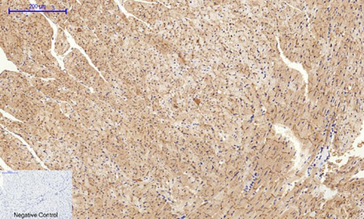 Fig.5. Immunohistochemical analysis of paraffin-embedded mouse heart tissue. 1, Connexin 43 Polyclonal Antibody was diluted at 1:200 (4°C, overnight). 2, Sodium citrate pH 6.0 was used for antibody retrieval (>98°C, 20min). 3, secondary antibody was diluted at 1:200 (room temperature, 30min). Negative control was used by secondary antibody only.