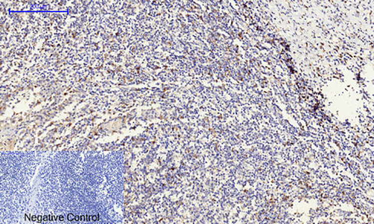 Fig.4. Immunohistochemical analysis of paraffin-embedded human tonsil tissue. 1, c-Src Polyclonal Antibody was diluted at 1:200 (4°C, overnight). 2, Sodium citrate pH 6.0 was used for antibody retrieval (>98°C, 20min). 3, secondary antibody was diluted at 1:200 (room temperature, 30min). Negative control was used by secondary antibody only.
