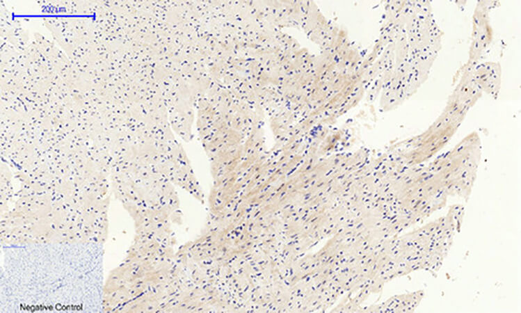 Fig.5. Immunohistochemical analysis of paraffin-embedded mouse heart tissue. 1, c-Src Polyclonal Antibody was diluted at 1:200 (4°C, overnight). 2, Sodium citrate pH 6.0 was used for antibody retrieval (>98°C, 20min). 3, secondary antibody was diluted at 1:200 (room temperature, 30min). Negative control was used by secondary antibody only.