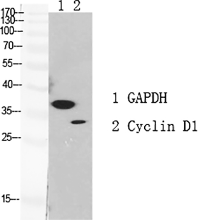 Fig.1. Western Blot analysis of GAPDH (1), Cyclin D1 (2), diluted at 1:1000.