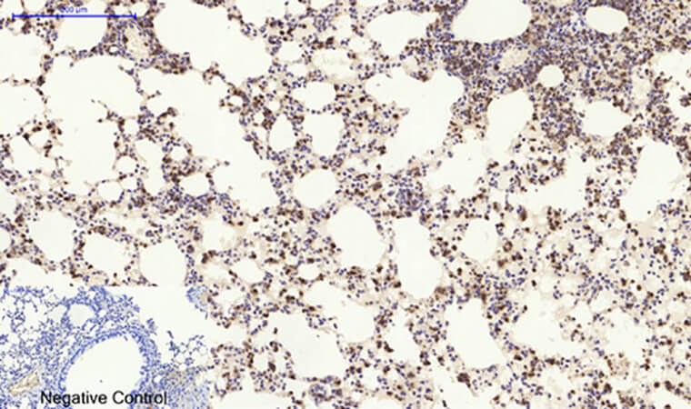 Fig.4. Immunohistochemical analysis of paraffin-embedded mouse lung tissue. 1, Cyclin D1 Polyclonal Antibody was diluted at 1:200 (4°C, overnight). 2, Sodium citrate pH 6.0 was used for antibody retrieval (>98°C, 20min). 3, secondary antibody was diluted at 1:200 (room temperature, 30min). Negative control was used by secondary antibody only.
