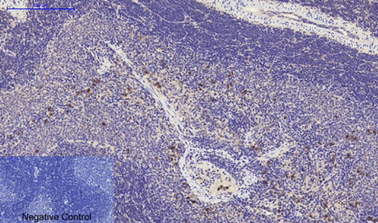 Fig.5. Immunohistochemical analysis of paraffin-embedded rat spleen tissue. 1, Cyclin D1 Polyclonal Antibody was diluted at 1:200 (4°C, overnight). 2, Sodium citrate pH 6.0 was used for antibody retrieval (>98°C, 20min). 3, secondary antibody was diluted at 1:200 (room temperature, 30min). Negative control was used by secondary antibody only.