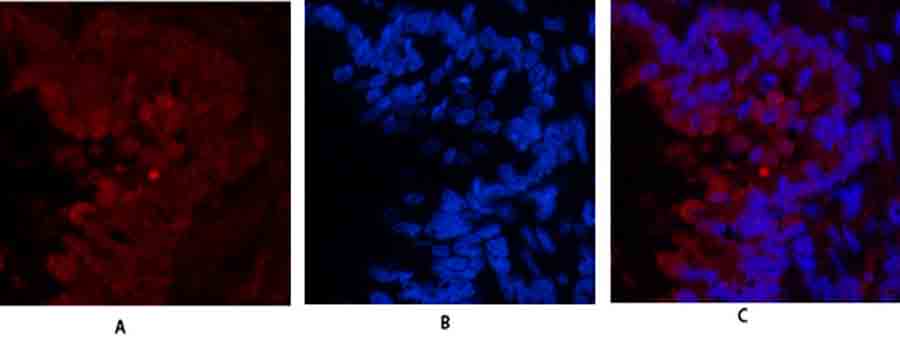 Fig.2. Immunofluorescence analysis of rat lung tissue. 1, Cyclin E1 Polyclonal Antibody (red) was diluted at 1:200 (4°,overnight). 2, Cy3 labeled secondary antibody was diluted at 1:300 (room temperature, 50min). 3, Picture B: DAPI (blue) 10min. Picture A: Target. Picture B: DAPI. Picture C: merge of A+B.