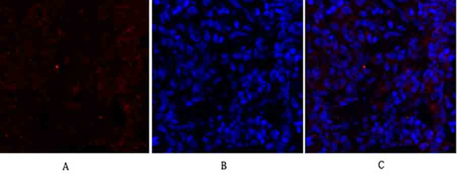 Fig.3. Immunofluorescence analysis of rat lung tissue. 1, Cytokeratin 18 Polyclonal Antibody (red) was diluted at 1:200 (4°C, overnight). 2, Cy3 labeled secondary antibody was diluted at 1:300 (room temperature, 50min). 3, Picture B: DAPI (blue) 10min. Picture A: Target. Picture B: DAPI. Picture C: merge of A+B.