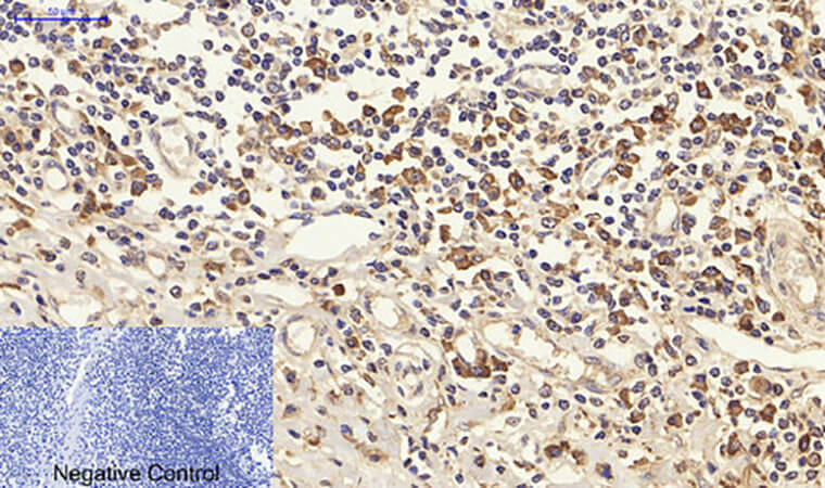 Fig.4. Immunohistochemical analysis of paraffin-embedded human tonsil tissue. 1, CytokeRatin 18 Polyclonal Antibody was diluted at 1:200 (4°C, overnight). 2, Sodium citrate pH 6.0 was used for antibody retrieval (>98°C, 20min). 3, secondary antibody was diluted at 1:200 (room temperature, 30min). Negative control was used by secondary antibody only.