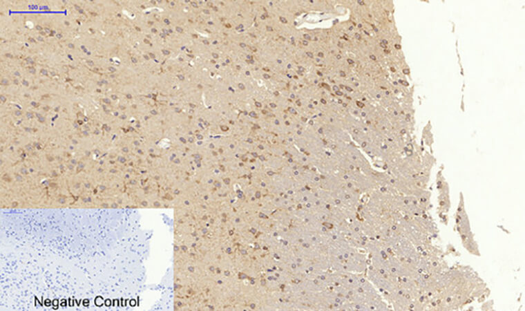 Fig.6. Immunohistochemical analysis of paraffin-embedded rat brain tissue. 1, CytokeRatin 18 Polyclonal Antibody was diluted at 1:200 (4°C, overnight). 2, Sodium citrate pH 6.0 was used for antibody retrieval (>98°C, 20min). 3, secondary antibody was diluted at 1:200 (room temperature, 30min). Negative control was used by secondary antibody only.