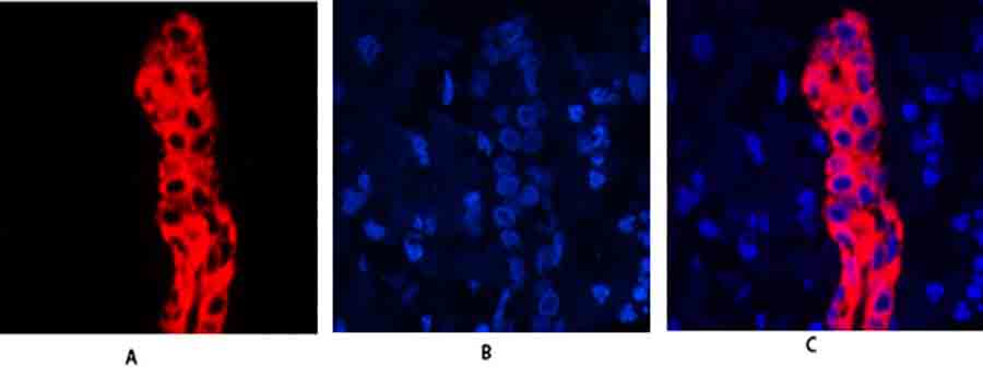 Fig.1. Immunofluorescence analysis of human liver tissue. 1, Cytokeratin 19 Polyclonal Antibody (red) was diluted at 1:200 (4°,overnight). 2, Cy3 labeled secondary antibody was diluted at 1:300 (room temperature, 50min). 3, Picture B: DAPI (blue) 10min. Picture A: Target. Picture B: DAPI. Picture C: merge of A+B.