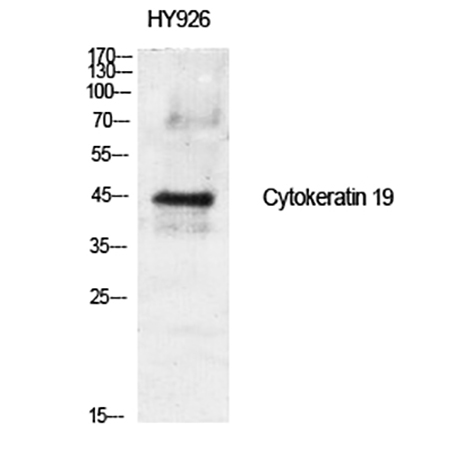 Fig.2. Western Blot analysis of various cells using Cytokeratin 19 Polyclonal Antibody diluted at 1:1000.