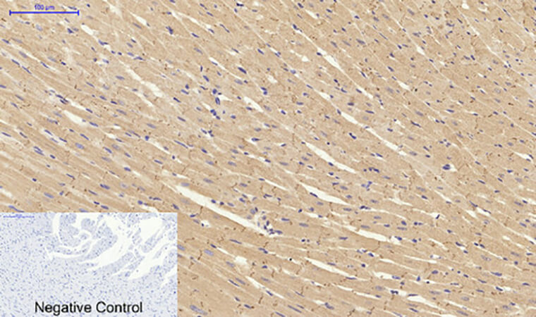Fig.4. Immunohistochemical analysis of paraffin-embedded rat heart tissue. 1, CytokeRatin 19 Polyclonal Antibody was diluted at 1:200 (4°C, overnight). 2, Sodium citrate pH 6.0 was used for antibody retrieval (>98°C, 20min). 3, secondary antibody was diluted at 1:200 (room temperature, 30min). Negative control was used by secondary antibody only.