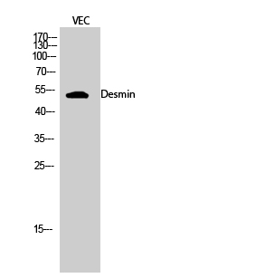 Fig.2. Western Blot analysis of VEC cells using Desmin Polyclonal Antibody diluted at 1:2000.