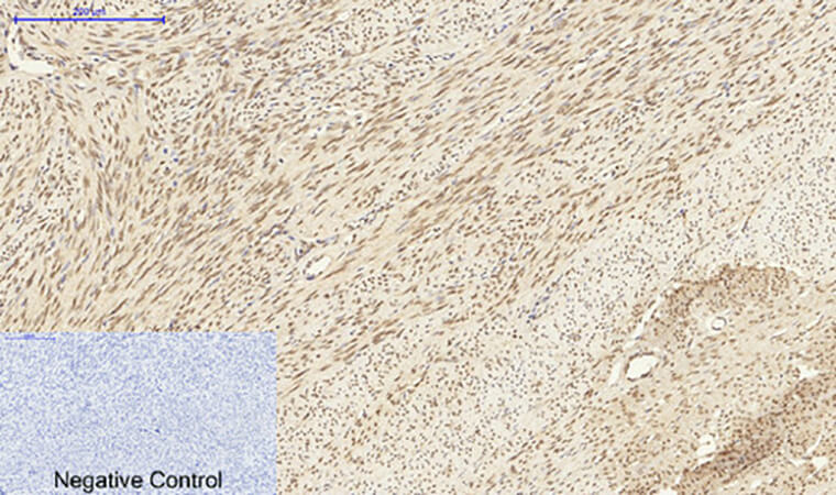 Fig.3. Immunohistochemical analysis of paraffin-embedded human uterus tissue. 1, Dnmt3b Polyclonal Antibody was diluted at 1:200 (4°C, overnight). 2, Sodium citrate pH 6.0 was used for antibody retrieval (>98°C, 20min). 3, secondary antibody was diluted at 1:200 (room temperature, 30min). Negative control was used by secondary antibody only.