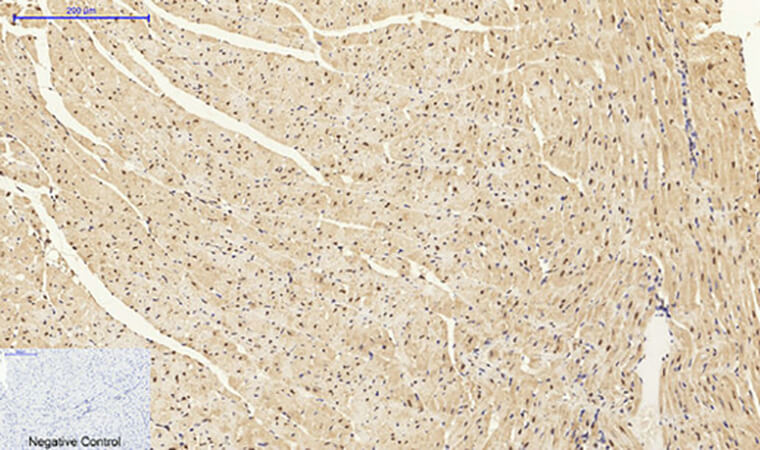 Fig.4. Immunohistochemical analysis of paraffin-embedded mouse heart tissue. 1, Dnmt3b Polyclonal Antibody was diluted at 1:200 (4°C, overnight). 2, Sodium citrate pH 6.0 was used for antibody retrieval (>98°C, 20min). 3, secondary antibody was diluted at 1:200 (room temperature, 30min). Negative control was used by secondary antibody only.