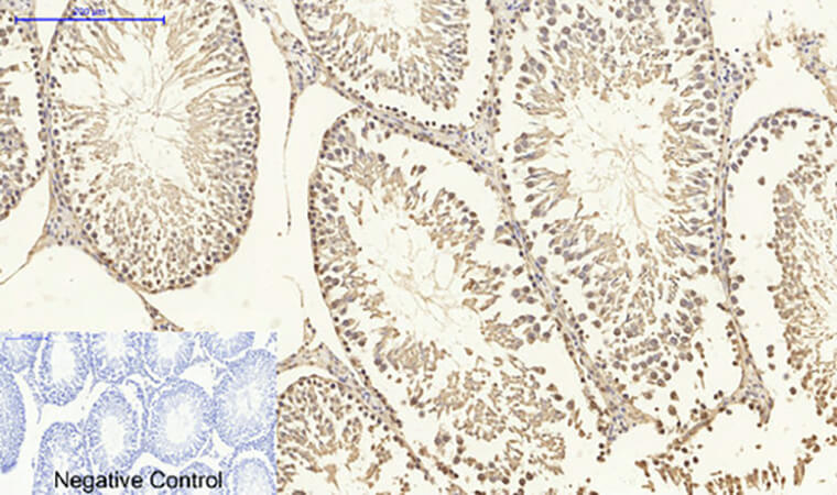 Fig.5. Immunohistochemical analysis of paraffin-embedded rat testis tissue. 1, Dnmt3b Polyclonal Antibody was diluted at 1:200 (4°C, overnight). 2, Sodium citrate pH 6.0 was used for antibody retrieval (>98°C, 20min). 3, secondary antibody was diluted at 1:200 (room temperature, 30min). Negative control was used by secondary antibody only.