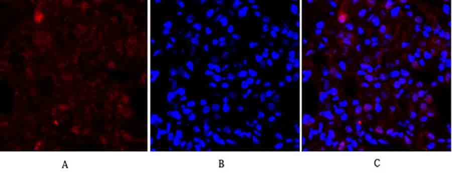 Fig.3. Immunofluorescence analysis of rat lung tissue. 1, E-cadherin Polyclonal Antibody (red) was diluted at 1:200 (4°C, overnight). 2, Cy3 labeled secondary antibody was diluted at 1:300 (room temperature, 50min). 3, Picture B: DAPI (blue) 10min. Picture A: Target. Picture B: DAPI. Picture C: merge of A+B.