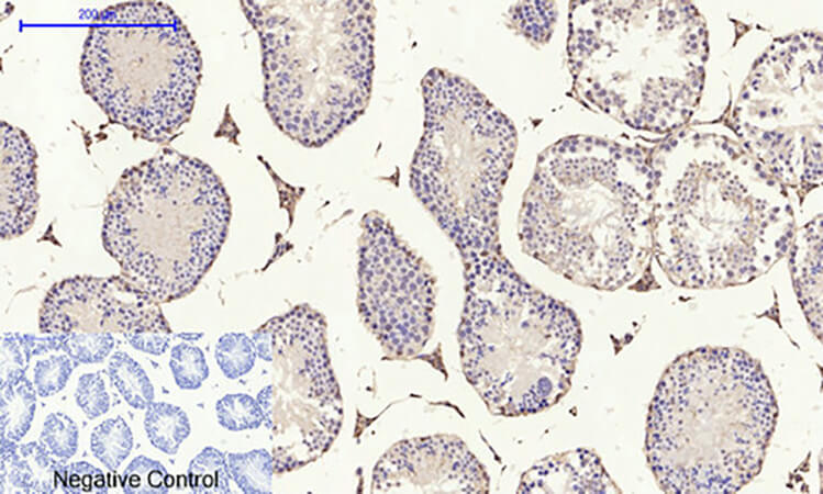 Fig.5. Immunohistochemical analysis of paraffin-embedded mouse testis tissue. 1, E-cadherin Polyclonal Antibody was diluted at 1:200 (4°C, overnight). 2, Sodium citrate pH 6.0 was used for antibody retrieval (>98°C, 20min). 3, secondary antibody was diluted at 1:200 (room temperature, 30min). Negative control was used by secondary antibody only.