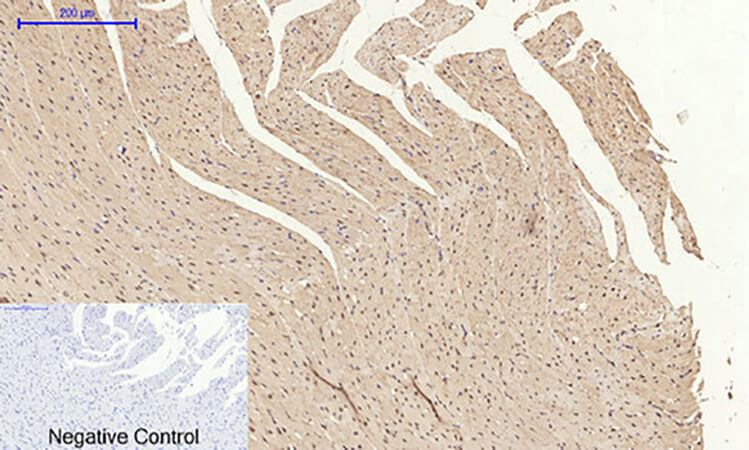 Fig.6. Immunohistochemical analysis of paraffin-embedded rat heart tissue. 1, E-cadherin Polyclonal Antibody was diluted at 1:200 (4°C, overnight). 2, Sodium citrate pH 6.0 was used for antibody retrieval (>98°C, 20min). 3, secondary antibody was diluted at 1:200 (room temperature, 30min). Negative control was used by secondary antibody only.