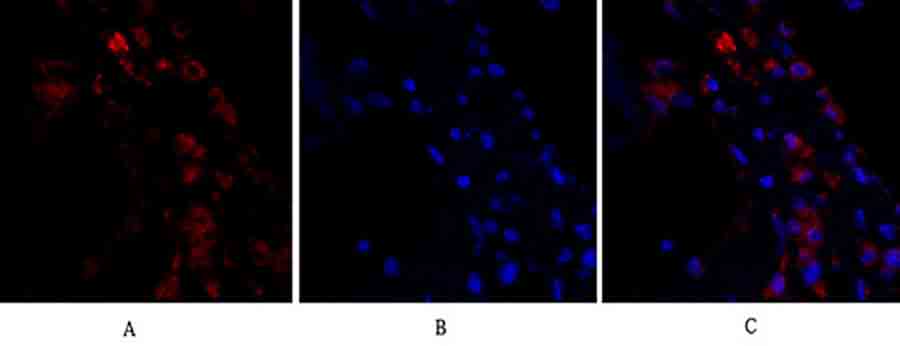 Fig.2. Immunofluorescence analysis of human lung tissue. 1, ERK 1/2 Polyclonal Antibody (red) was diluted at 1:200 (4°C, overnight). 2, Cy3 Labeled secondary antibody was diluted at 1:300 (room temperature, 50min). 3, Picture B: DAPI (blue) 10min. Picture A: Target. Picture B: DAPI. Picture C: merge of A+B.