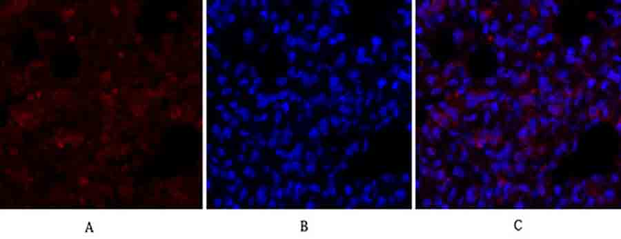 Fig.3. Immunofluorescence analysis of rat lung tissue. 1, ERK 1/2 Polyclonal Antibody (red) was diluted at 1:200 (4°C, overnight). 2, Cy3 Labeled secondary antibody was diluted at 1:300 (room temperature, 50min). 3, Picture B: DAPI (blue) 10min. Picture A: Target. Picture B: DAPI. Picture C: merge of A+B.