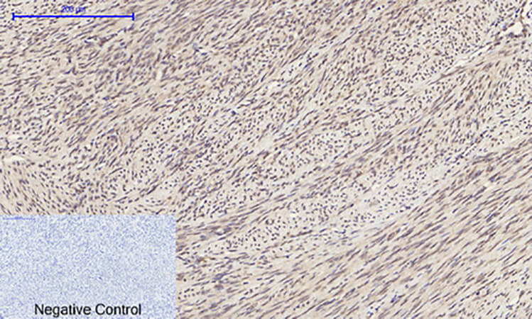Fig.4. Immunohistochemical analysis of paraffin-embedded human uterus tissue. 1, ERK 1/2 Polyclonal Antibody was diluted at 1:200 (4°C, overnight). 2, Sodium citrate pH 6.0 was used for antibody retrieval (>98°C, 20min). 3, secondary antibody was diluted at 1:200 (room temperature, 30min). Negative control was used by secondary antibody only.