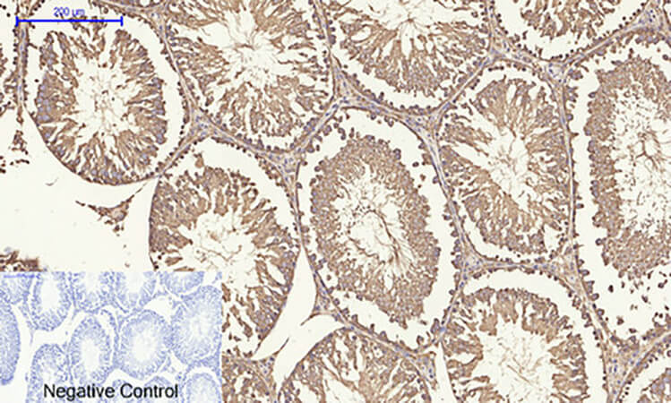 Fig.6. Immunohistochemical analysis of paraffin-embedded rat testis tissue. 1, ERK 1/2 Polyclonal Antibody was diluted at 1:200 (4°C, overnight). 2, Sodium citrate pH 6.0 was used for antibody retrieval (>98°C, 20min). 3, secondary antibody was diluted at 1:200 (room temperature, 30min). Negative control was used by secondary antibody only.