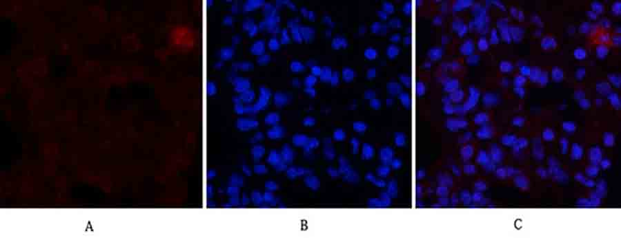 Fig.2. Immunofluorescence analysis of rat lung tissue. 1, ERα Polyclonal Antibody (red) was diluted at 1:200 (4°C, overnight). 2, Cy3 Labeled secondary antibody was diluted at 1:300 (room temperature, 50min). 3, Picture B: DAPI (blue) 10min. Picture A: Target. Picture B: DAPI. Picture C: merge of A+B.