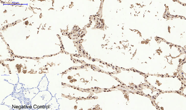 Fig.3. Immunohistochemical analysis of paraffin-embedded human lung tissue. 1, ERα Polyclonal Antibody was diluted at 1:200 (4°C, overnight). 2, Sodium citrate pH 6.0 was used for antibody retrieval (>98°C, 20min). 3, secondary antibody was diluted at 1:200 (room temperature, 30min). Negative control was used by secondary antibody only.