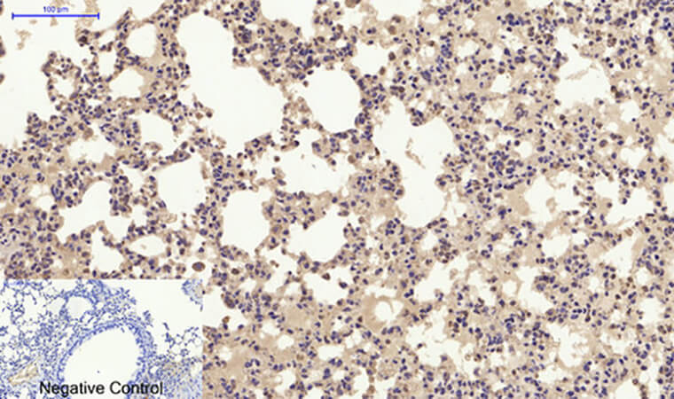 Fig.4. Immunohistochemical analysis of paraffin-embedded mouse lung tissue. 1, ERα Polyclonal Antibody was diluted at 1:200 (4°C, overnight). 2, Sodium citrate pH 6.0 was used for antibody retrieval (>98°C, 20min). 3, secondary antibody was diluted at 1:200 (room temperature, 30min). Negative control was used by secondary antibody only.