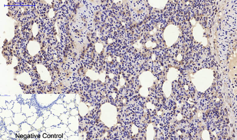 Fig.5. Immunohistochemical analysis of paraffin-embedded rat lung tissue. 1, ERα Polyclonal Antibody was diluted at 1:200 (4°C, overnight). 2, Sodium citrate pH 6.0 was used for antibody retrieval (>98°C, 20min). 3, secondary antibody was diluted at 1:200 (room temperature, 30min). Negative control was used by secondary antibody only.